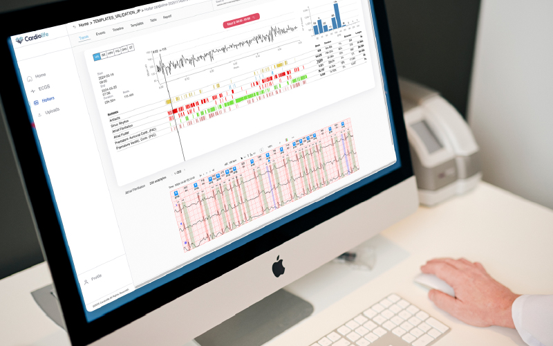 AI enhances the ability to detect and predict heart disease